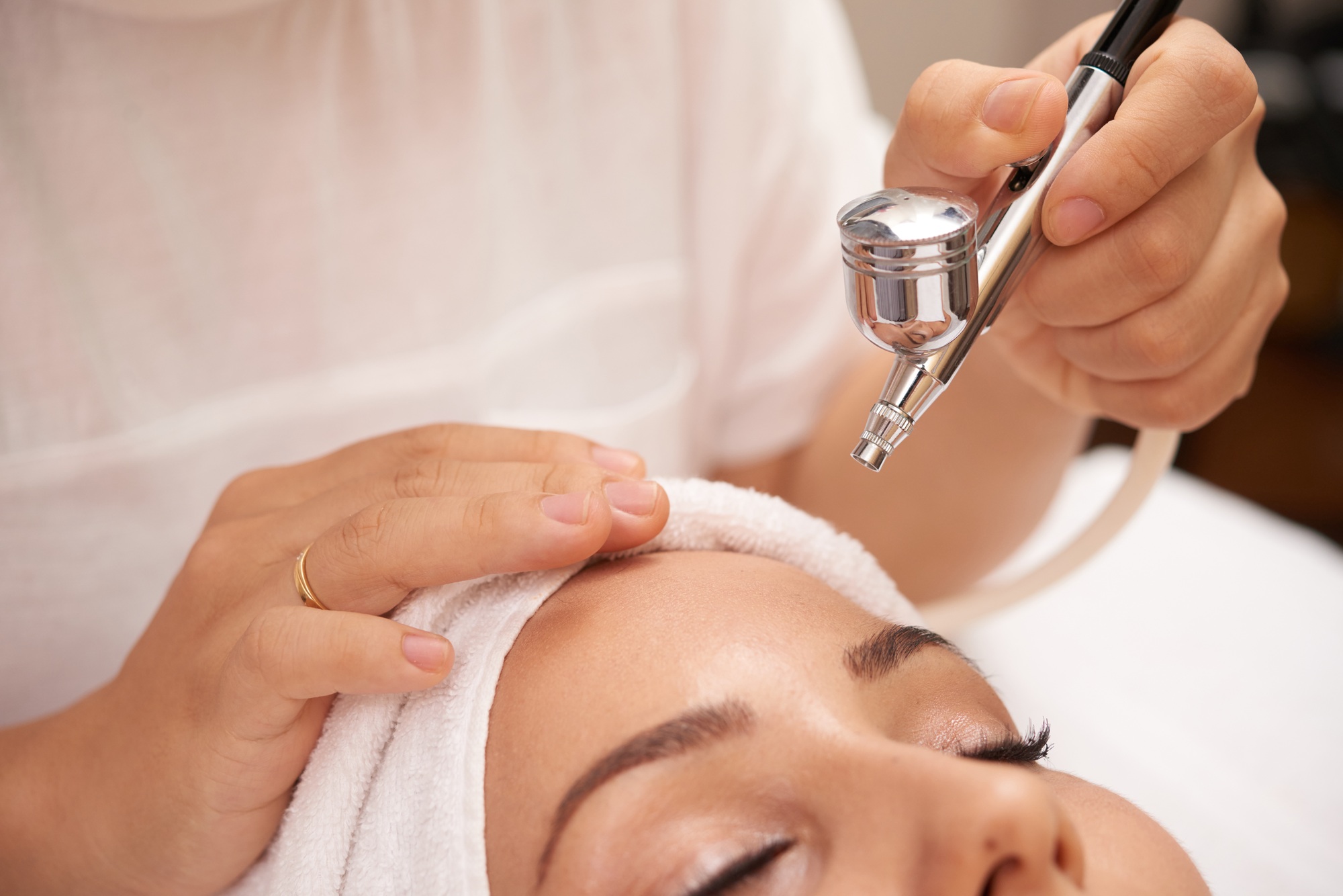 Laser procedure